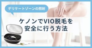 【VIO脱毛】ケノンを使ったデリケートゾーンの照射を安全に行う方法