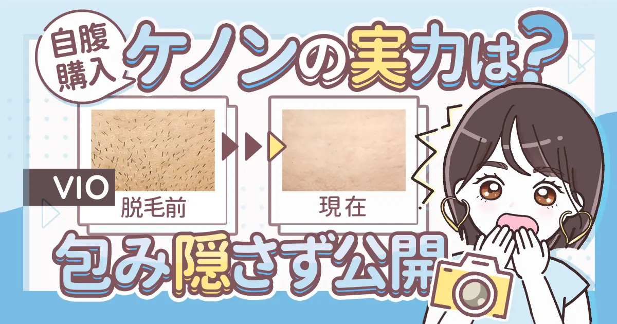 ケノン脱毛器使用回数数回 1〜7回の経過写真】ケノンでVIO脱毛-3ヶ月でどう変わった？1年後の状態