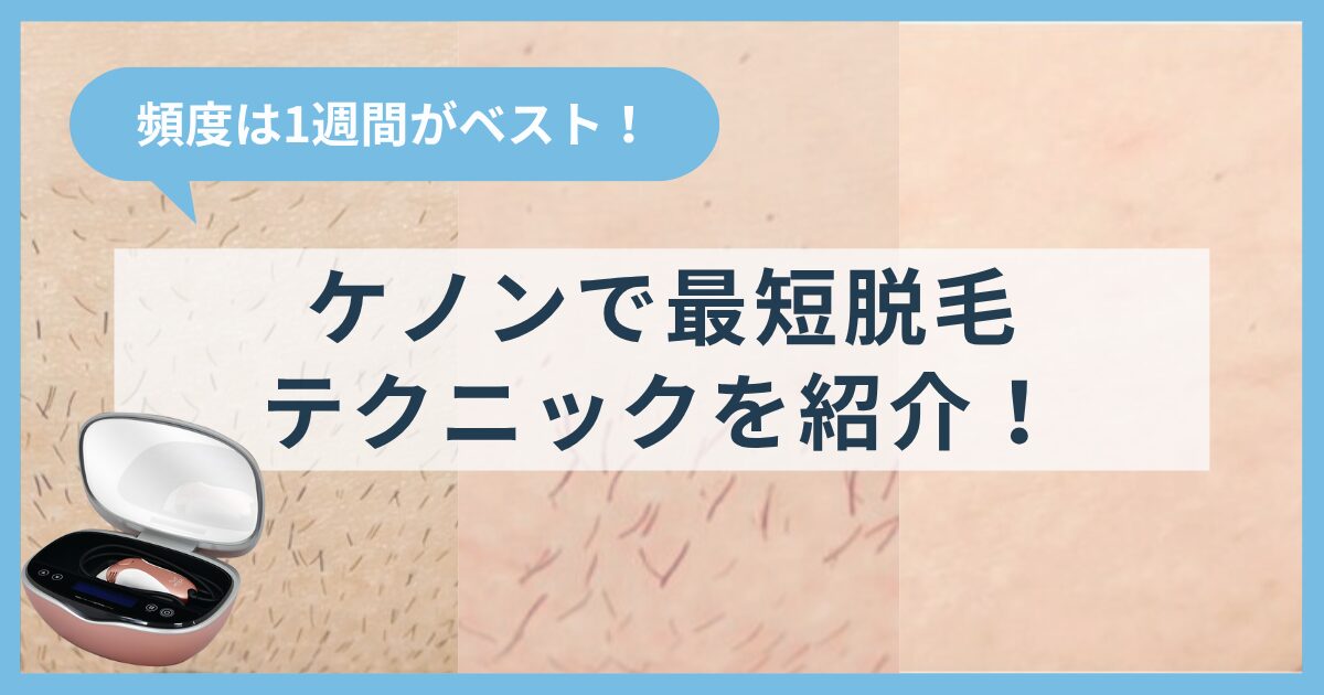 ケノンの頻度は1週間がベスト！最短で脱毛を終わらせるテクニックも紹介！