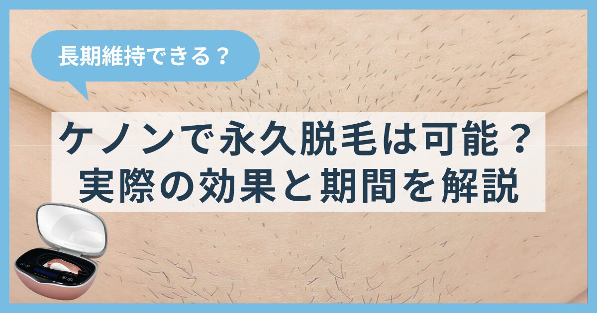 ケノンで永久脱毛は可能?実際の効果と長期維持できる期間について解説