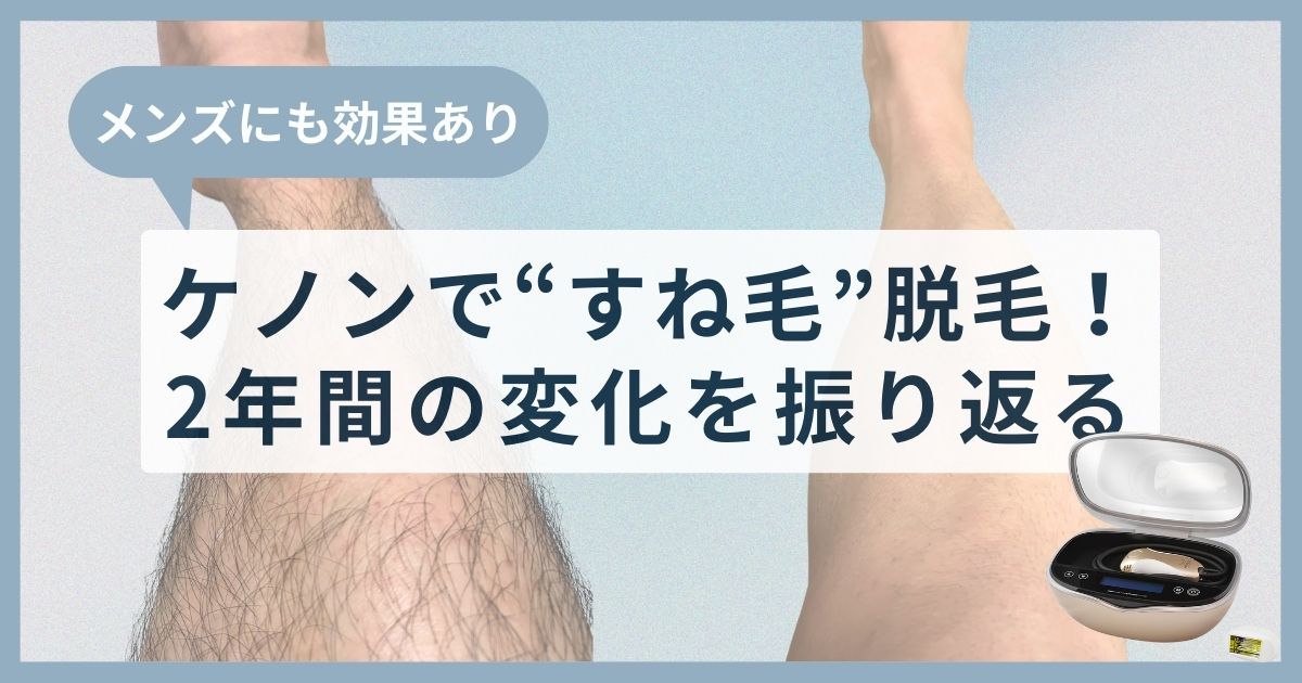 ケノンで“すね毛”脱毛！ 2年間の変化を振り返る