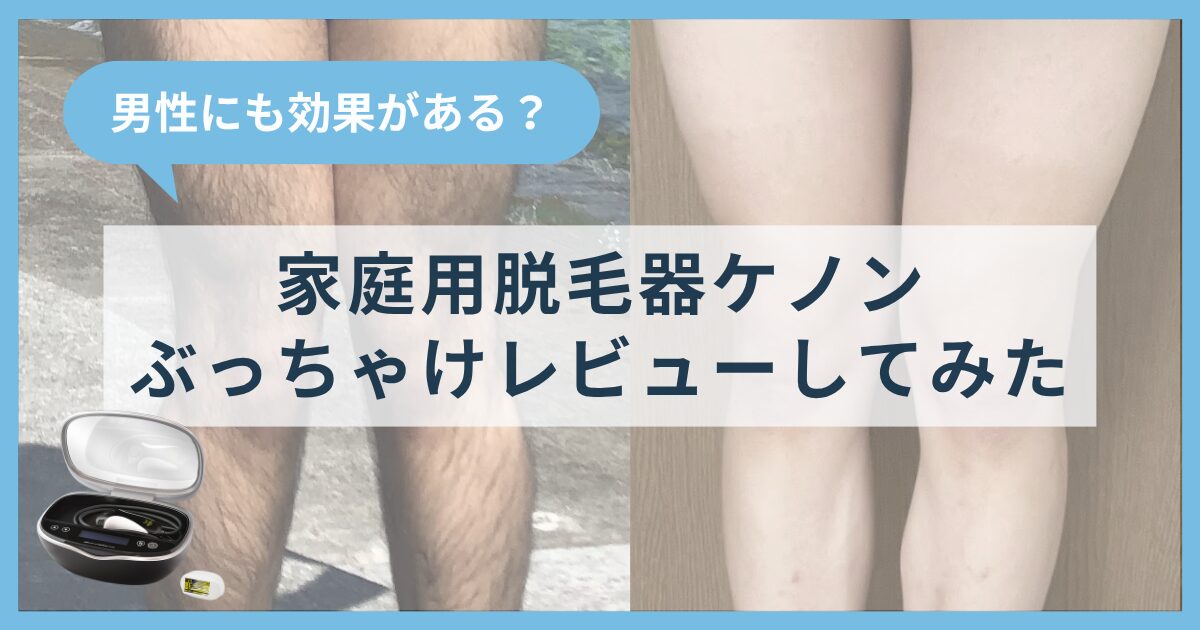 家庭用脱毛器ケノンは男性が使っても効果があるのか？実際に使ってぶっちゃけレビューしてみた