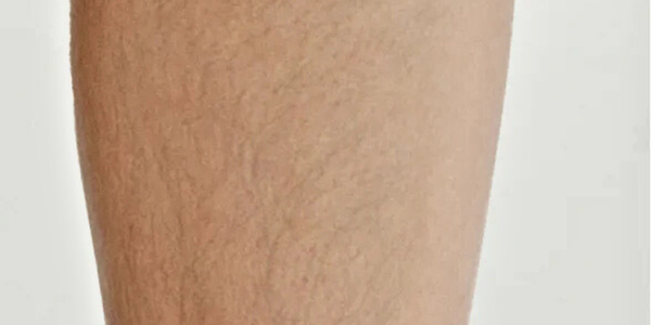 ulike-air10-before