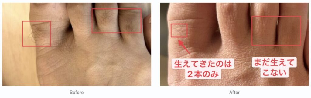 毛の変化の解説をする写真