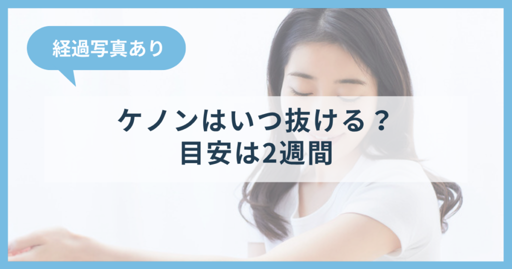 ケノンで照射した毛が抜けるまでの日数