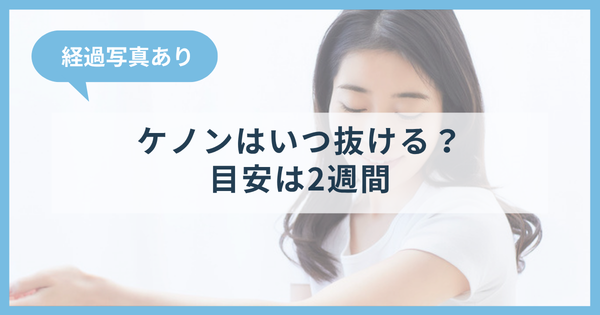 ケノンで照射した毛が抜けるまでの日数