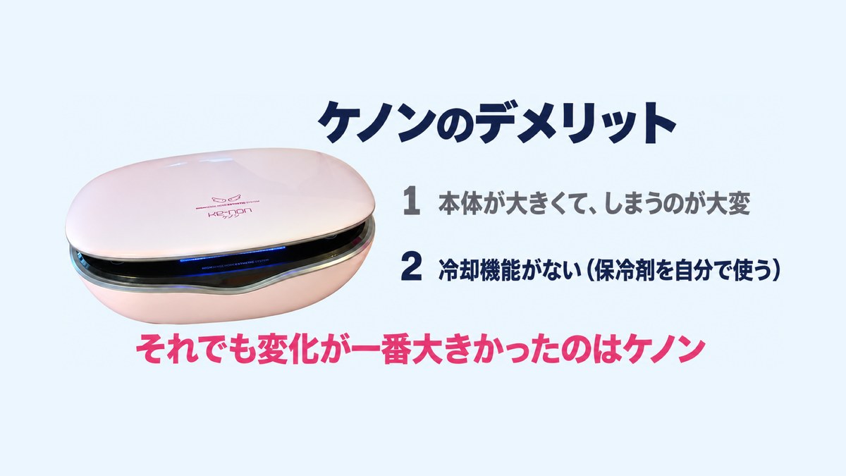 ケノンの注意点：本体が大きくしまうのが大変、冷却機能がない。それでも変化が一番大きかったのはケノン